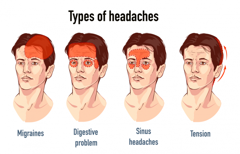 What is Headaches?